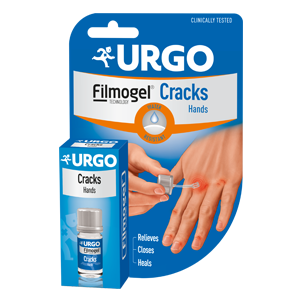 CRACKS-HANDS